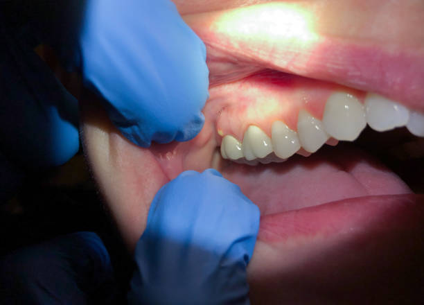 Best Emergency Dentist for Special Needs Patients in Crockett, CA