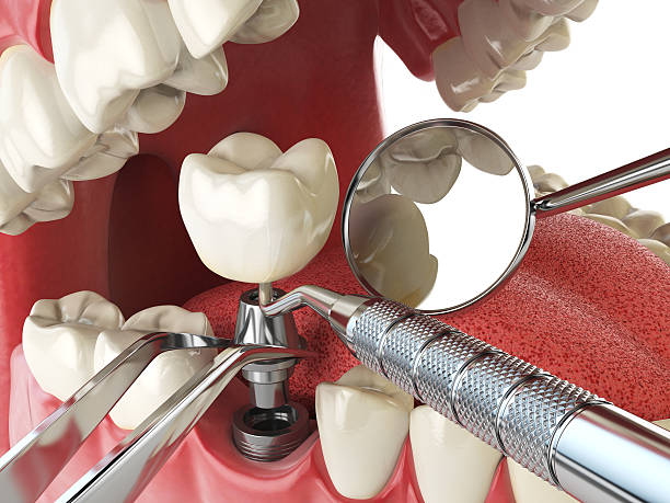 Best Mobile Emergency Dentist in Crockett, CA